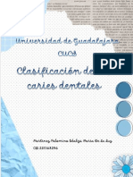 Clasificacion de Las Caries