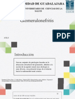 Glomerulonefritis