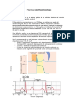 Práctica Electrocardiograma