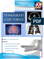 Tomografia de Torax Con Contraste