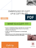 Embryology of Cleft Lip & Cleft Palate