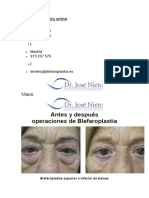 Httpsblefaroplastiaes