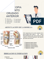 Artroscopia Ligamento Cruzado Anterior