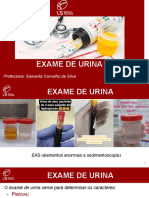 EXAMES de Urina