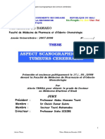 Aspect Scanographique Des Tumeurs Cerebrales: Universite de Bamako