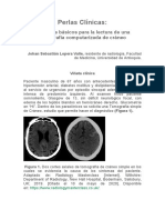 Aspectos Básicos para La Lectura de Una Tomografía Computarizada de Cráneo