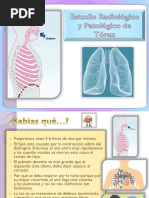 Radiografia de Tórax