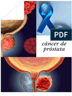 Cancer de Prostata