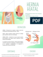 Hernia Hiatal