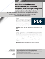 Tratamento Cirúrgico Do Hálux Valgo de Moderada Deformidade Pela Técnica de Reconstrução Distal de Partes Moles: Avaliação Radiográfica