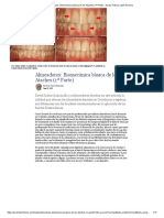 Alineadores - Biomecánica Básica de Los Ataches (1 Parte) - Dental Tribune Latin America