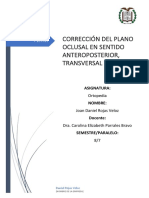 Corrección Del Plano Oclusal