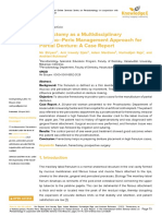 Frenectomy As A Multidisciplinary Prostho-Perio Management Approach For Partial Denture-A Case Report