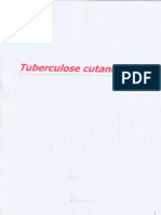 Tuberculose Cutanée - DR - EL OSMANI