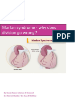 Marfan Syndrome