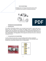 Resin Bonded Bridges