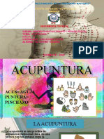 ACUPUNTURA