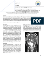 Cerebellopontine Angle Epidermoid CYST: Case Report