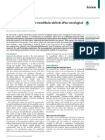 Mandibular Defects