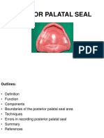 Posterior Palatal Seal