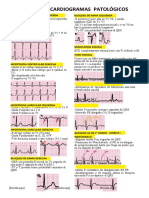 RESUMEN Ecg Patologico