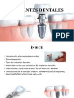 Implantes Dentales