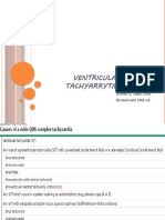 Ventricular Tachyarrythmias