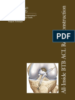 Arthrex All Inside ACL Repair BTB