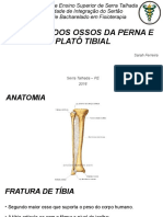 3 Fratura Dos Ossos Da Perna e Platô Tibial