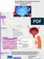 Cáncer de Vejiga Musculo Invasor