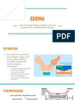 EDEMA