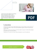 Leucemia Infantil