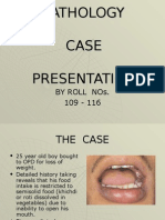 Oral Submucous Fibrosis