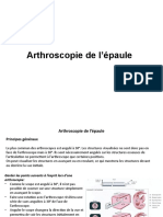 Arthroscopie de L'épaule