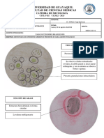 Practica 10 - Paracoccidioides Brasiliensis Blastomyces Dermatitis Coccidioides Immitis - Dibujos