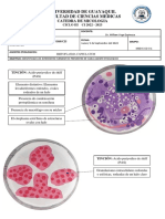 Practica 11 - Histoplasma Capsulatum y Talaromyces Marnefiee - Plastilinas Ana Garcia