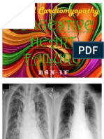 Dilated Cardiomyopathy Case Study