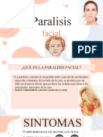 Paralisis Facial