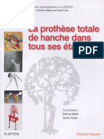 Orthopédie - La Prothése Totale de Hanche Dans Tous Ses Etats