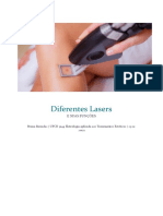 Diferentes Lasers e Suas Funções