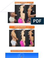 4 - EXERCÍCIOS - Tilt Anterior e Hiperlordose Lombar