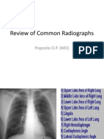 Common Xrays