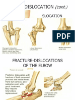 05 Fractures of The Upper Extremity Part 2 - Dr. Tan