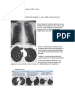 Seminário Imagiologia Pulmonar 1