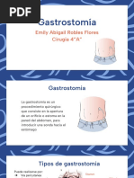 Gastrostomia