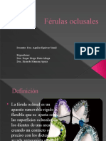 Ferulas Oclusales