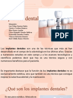 Implantes Dentales