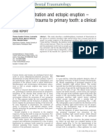 Apical Fenestration and Ectopic Eruption - Effects From Trauma To Primary Tooth: A Clinical Case Report