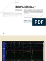 Electrofisiologia Cardiaca Guia Viasual 2 PDF