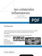 Quistes Colaterales Inflamatorios